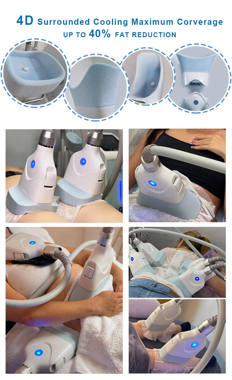 Best Cryolipolysis Treatment Best Cryolipolysis Treatment